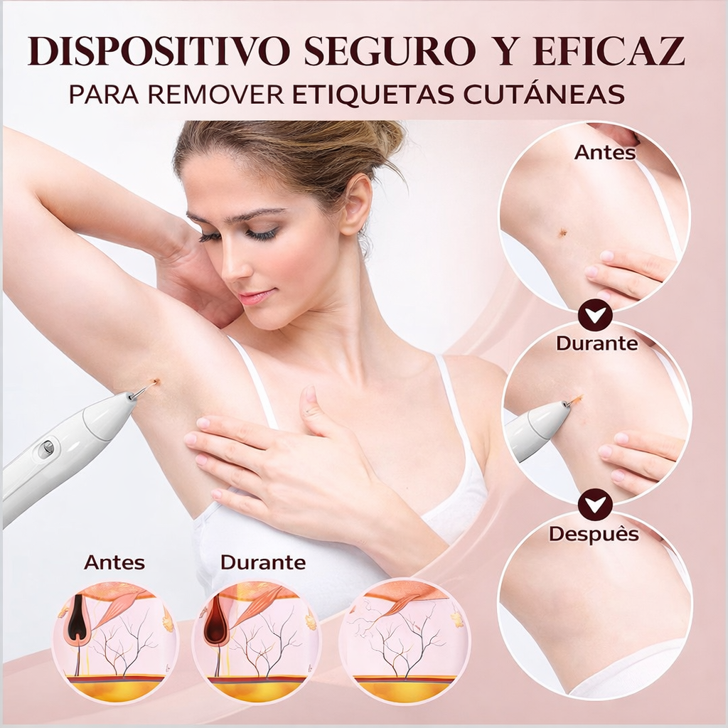Removedor Cauterizador Quita Verrugas Pecas De Plasma Láser