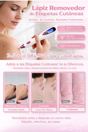 Removedor Cauterizador Quita Verrugas Pecas De Plasma Láser